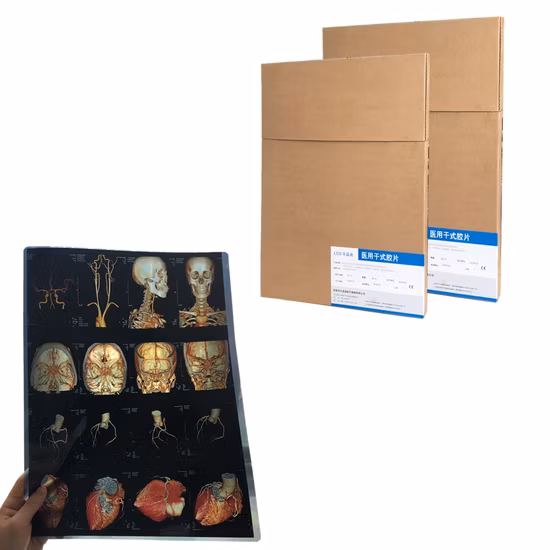 印刷可能なインクジェット画像メディア広告素材ペットマットバックライトフィルム